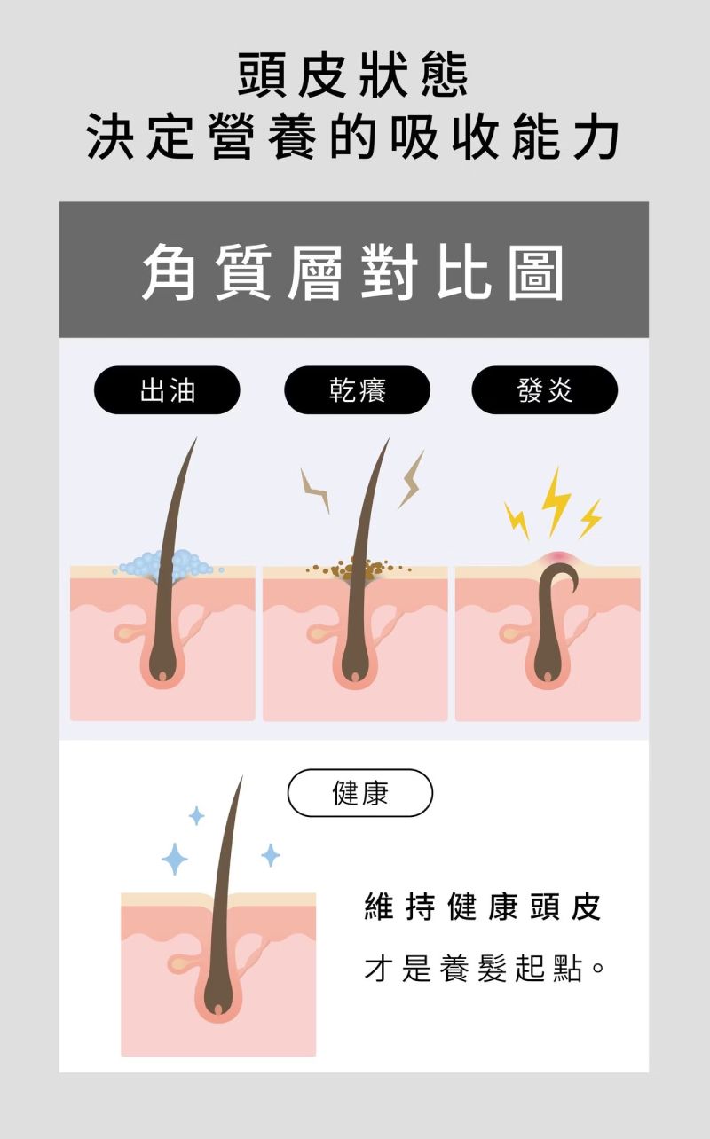 諾亞外泌體初源養髮液，維護健康頭皮環境，改善出油、乾癢與發炎困擾